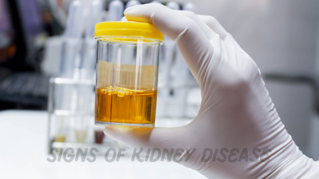 Signs of Kidney Disease